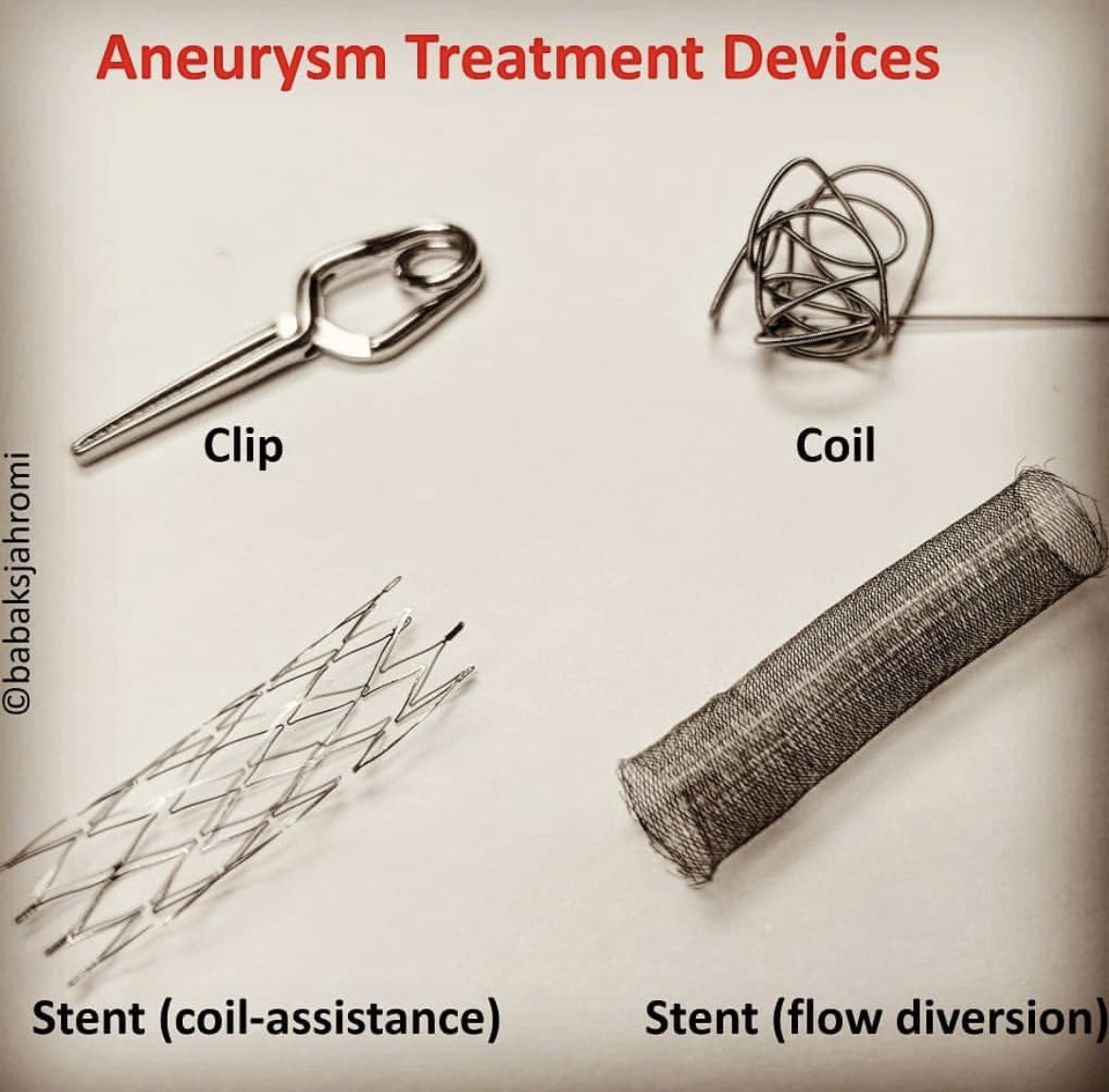 Oren Gottfried, MD on Twitter "Cerebral aneurysm are treated with