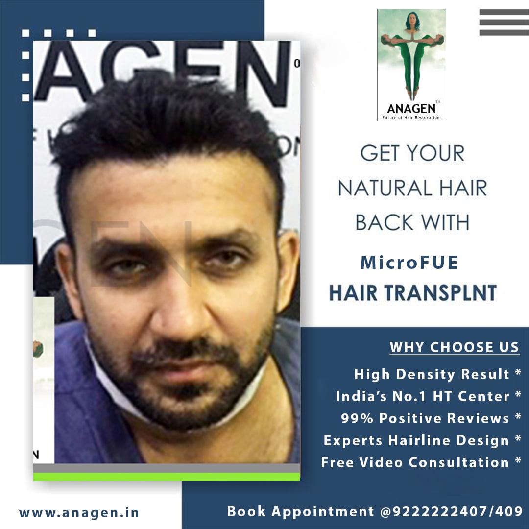 Anagen Hair Transplant Clinic (@Anagen_Clinic) / Twitter Anagen Hair Transplant Clinic (@Anagen_Clinic) / Twitter