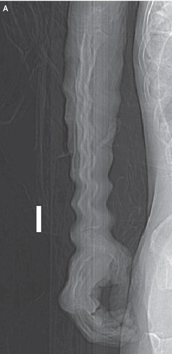 Avraham Z. Cooper, MD 🩺 tweet media