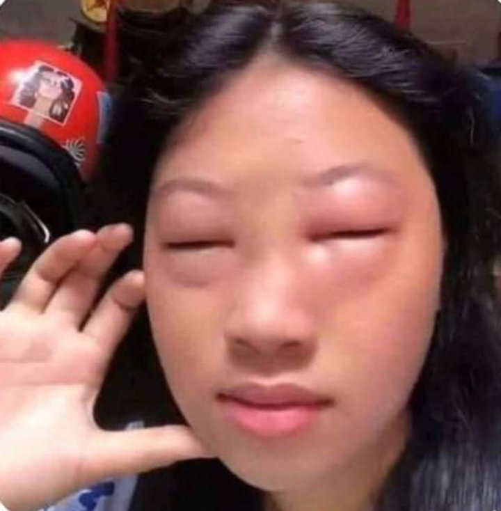 aloedami_'s tweet photo. teumes eyes when they woke up : https://t.co/sOiuxbPzMu
