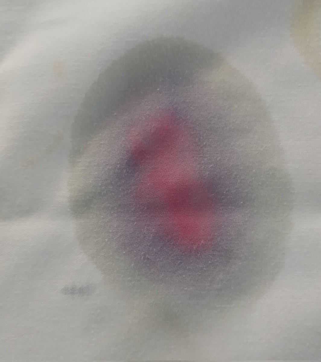 DrDunkyJim's tweet image. Some see a fruit tea stain, others a demonstration of natural dye separation by chromatography... #SciComm #SimpleScience