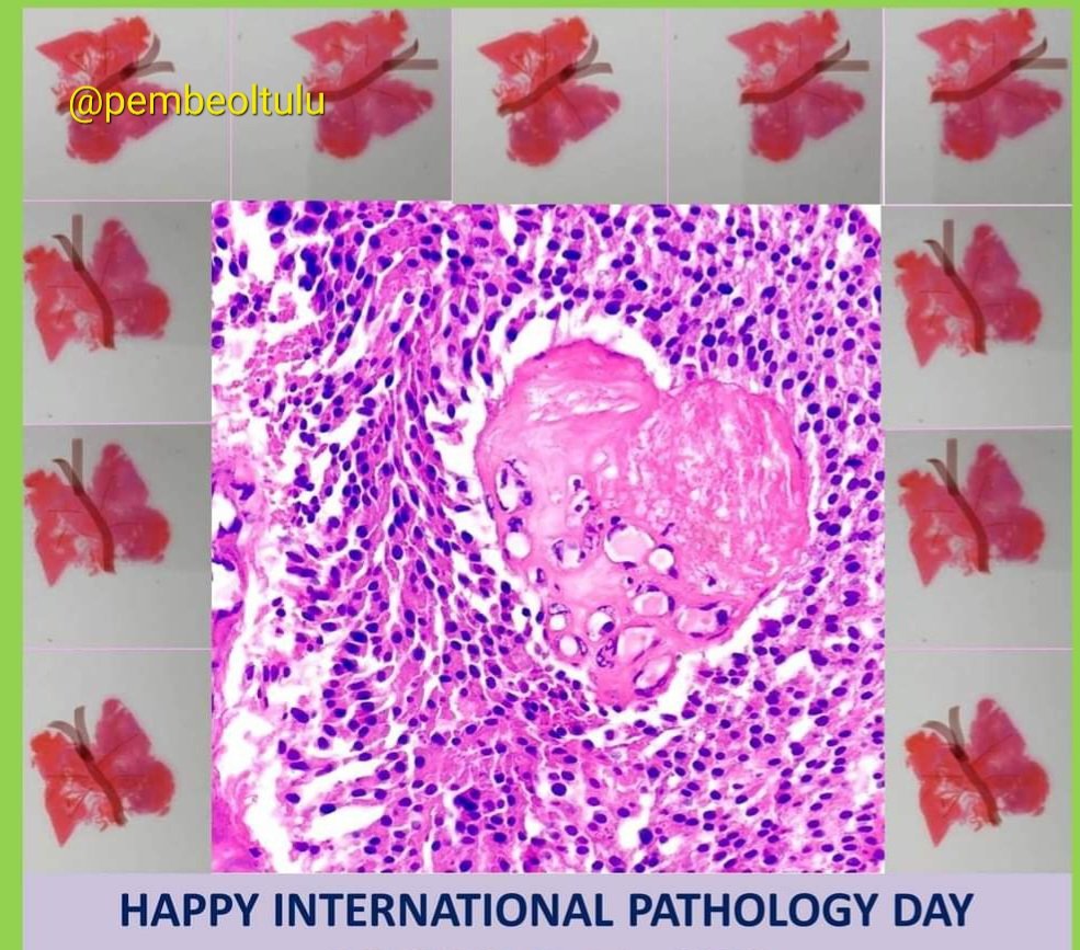 Pembe Oltulu, MD tweet media