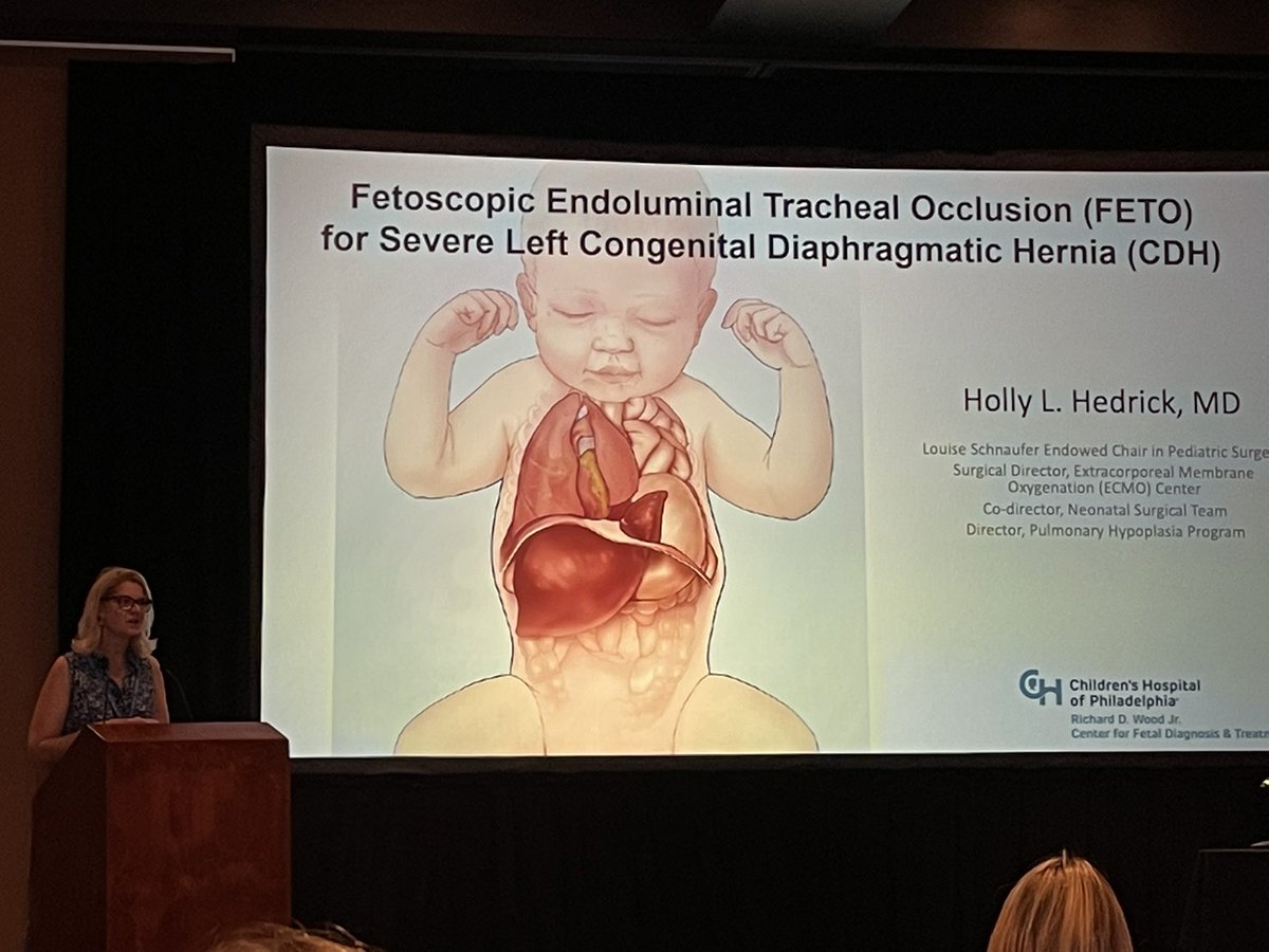 DrOliviaNelson (@drolivianelson1) on Twitter photo The one and only Dr. Hedrick presenting on use of FETO for severe CDH <a href="/CHOPFetalCenter/">CHOP Fetal Center</a> #IFMSS2022 <a href="/CHOP_Research/">CHOP Research</a> The one and only Dr. Hedrick presenting on use of FETO for severe CDH <a href="/CHOPFetalCenter/">CHOP Fetal Center</a> #IFMSS2022 <a href="/CHOP_Research/">CHOP Research</a>