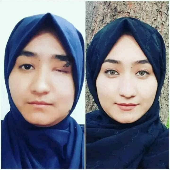 AsghariZarin's tweet photo. زنان تحصیل کرده و آینده نامعلوم در افغانستان 
دختران با سخت کوشی و مبارزه با سیاست‌ سرکوب و تبعیض جنسیتی در کانکور سراسری با نمرات خوب به دانشگاه راه یافتند این جای خوشحالی ست اما از نگرانی ها در مورد محدودیت و تبعيض جنسیتی در عرصه تحصیل و فرصت های شغلی نمی‌کاهد.#زن_تحصیل_کار https://t.co/DYSMcI0HdE