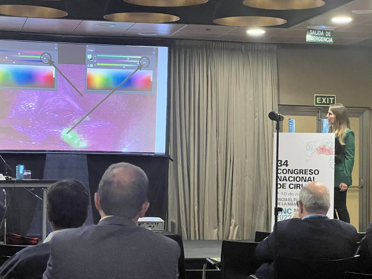 Natalia Pujol Cano (@npujolcano) on Twitter photo Exposición de la Dra. Ferrer <a href="/EsterInaebnit/">Ester Ferrer Inaebnit</a> sobre la CUANTIFICACIÓN DE LA INTENSIDAD DE FLUORESCENCIA DURANTE LA COLANGIOGRAFÍA CON ICG MEDIANTE UN SOFTWARE DE ANÁLISIS DEL COLOR BASADO EN EL MODELO DE COLOR RGB en <a href="/cncirugia2022/">Congreso Nacional de Cirugía</a> #cncirugia2022 Exposición de la Dra. Ferrer <a href="/EsterInaebnit/">Ester Ferrer Inaebnit</a> sobre la CUANTIFICACIÓN DE LA INTENSIDAD DE FLUORESCENCIA DURANTE LA COLANGIOGRAFÍA CON ICG MEDIANTE UN SOFTWARE DE ANÁLISIS DEL COLOR BASADO EN EL MODELO DE COLOR RGB en <a href="/cncirugia2022/">Congreso Nacional de Cirugía</a> #cncirugia2022