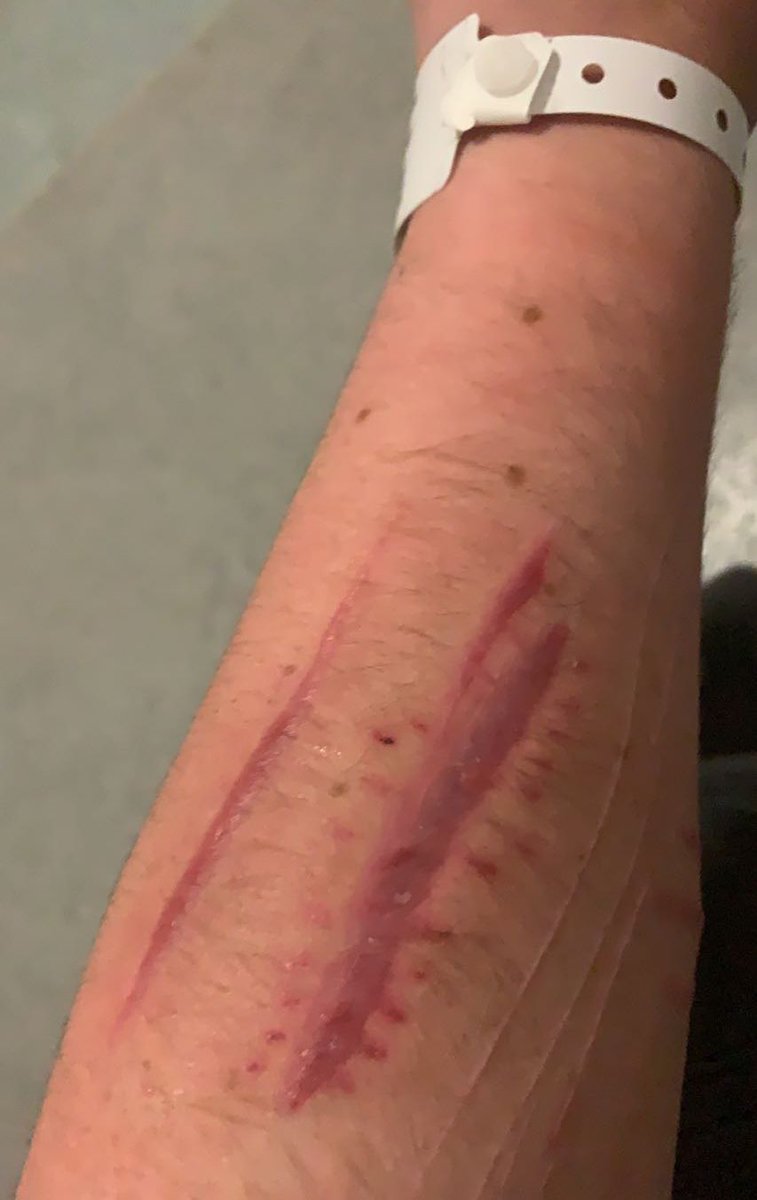 defiledbones's tweet image. scars

shtwt