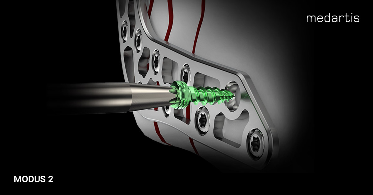 Medartis_Global's tweet image. SpeedTip – our self-drilling technology, TriLock – our unique locking technology and HexaDrive – our secure connection between screw and screwdriver for increased torque transmission and simplified screw pick-up. More info ➡️ medartis.com/en-us/products…​ #CMF #orthotwitter #MODUS2