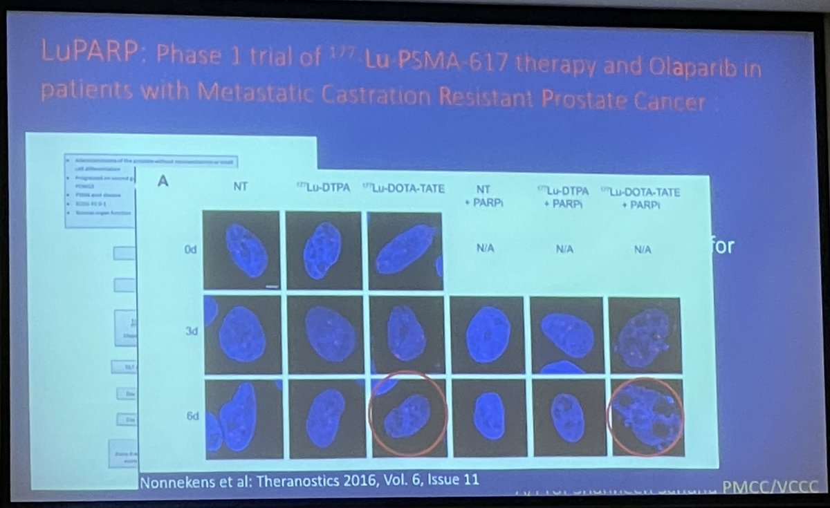 MarcDiocera's tweet photo. Prof @drlouiseemmett on everything #prostatecancer #theranostics. @pros_tic @gu_onc is very well represented 👏🏻. #PRINCE #LuPARP #EVOLUTION #LuTectomy #TheraP | @ANZUPtrials @USANZUrology https://t.co/lIUuZnSeJZ