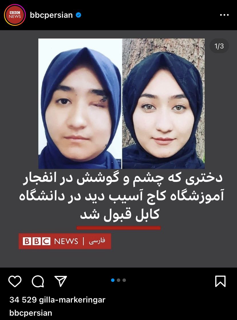 Razi_kaj's tweet photo. از امروز شما الگوی ما دختران هزاره هستی.
شجاعت، استقامت و صبر شما قابل تقدیر است.  #StopHazaraGenocide https://t.co/oCig3CH1hD