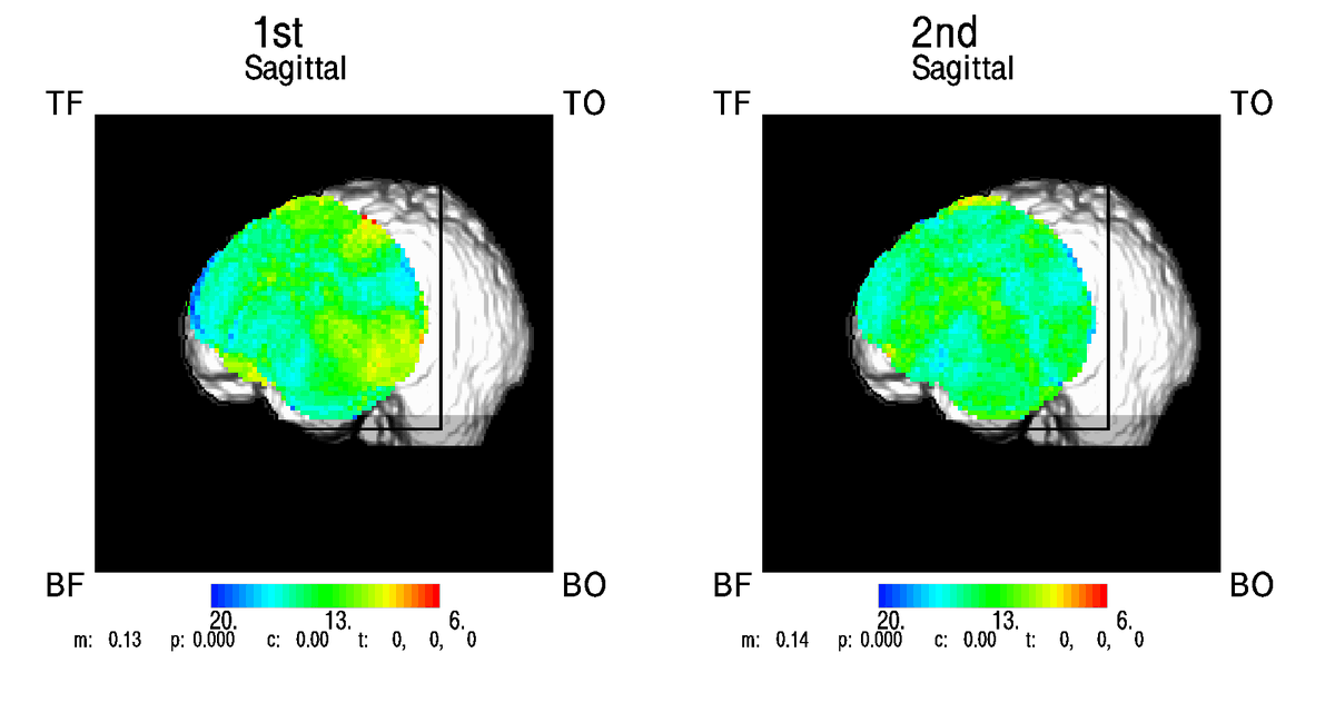 Jenna Johnson (@jenna_ejohnson) on Twitter photo Autumn leaves, pumpkin pie, and optical imaging. Thank you to <a href="/TheRealSPR/">TheRealSPR</a> for the wonderful opportunity to learn from the best at the <a href="/CNL_Illinois/">Cognitive Neuroimaging Laboratory - U of I</a> @fabianimonica1 <a href="/GabrieleGratton/">Gabriele Gratton</a> Autumn leaves, pumpkin pie, and optical imaging. Thank you to <a href="/TheRealSPR/">TheRealSPR</a> for the wonderful opportunity to learn from the best at the <a href="/CNL_Illinois/">Cognitive Neuroimaging Laboratory - U of I</a> @fabianimonica1 <a href="/GabrieleGratton/">Gabriele Gratton</a>