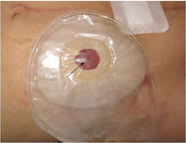 Bismillaah...
Usulan Menkeu Ibu Sri Mulyani utk menaikkan cukai rokok tidak bs untuk tidak saya duku...