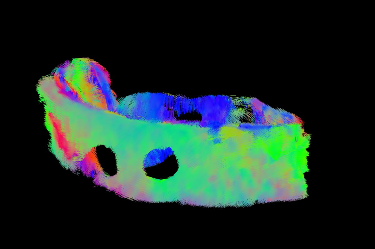 Our latest open access lab output co-led by <a href="/Ruth_Levey/">Ruth Levey</a> &amp; <a href="/btornifoglio/">Brooke Tornifoglio</a> in collaboration with <a href="/TrionaLally/">Tríona Lally</a>'s team <a href="/ambercentre/">AMBER</a> &amp; <a href="/tcdTCBE/">TCBE</a> - we use whole sample &amp; diffusion tensor imaging to assess the foreign body response to 2 human-sized macroencapsulation devices post-explant