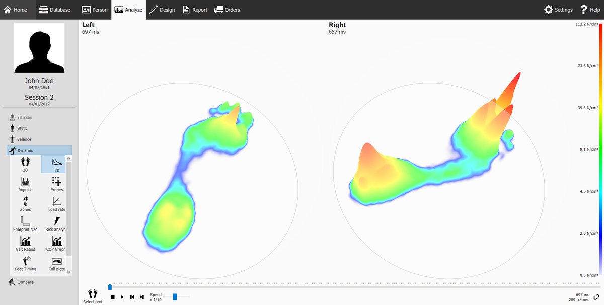 LilleshallClnc's tweet photo. Here at Lilleshall Clinic, we use Footscan technology to inform your podiatry assessment. We give feedback during the session with a full report. As required, we order your unique 3D-printed Phits orthotic insoles, based on your biomechanical assessment and needs. https://t.co/2odaQZAmvd