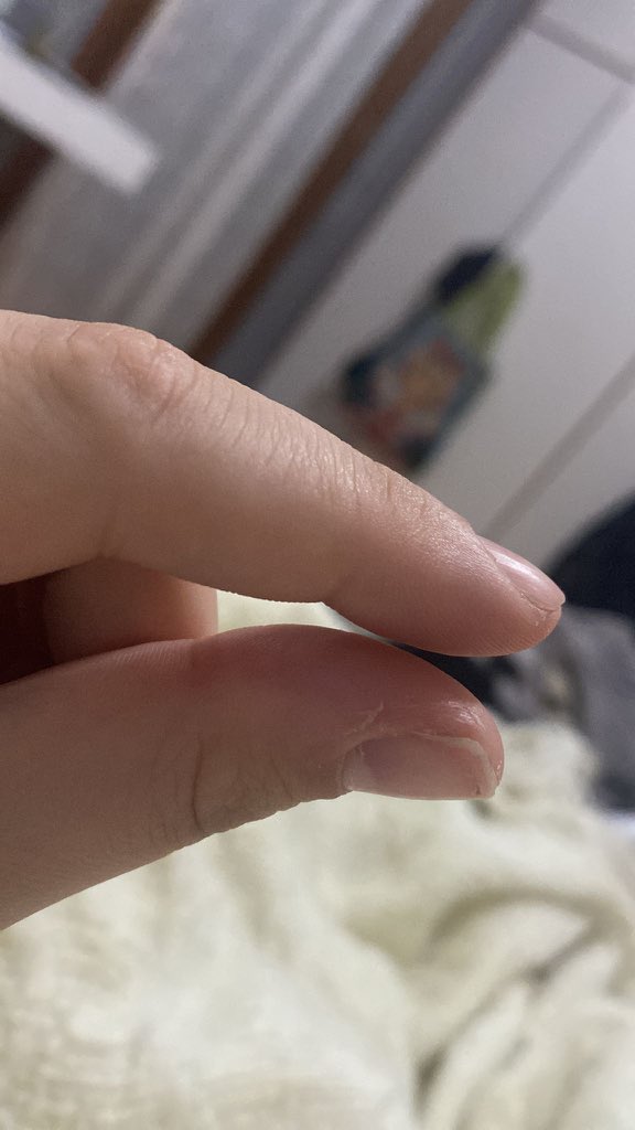 geosimeosiyeo's tweet photo. I’m this close to admit myself in a mental hospital… https://t.co/sq3Pqqzt5t