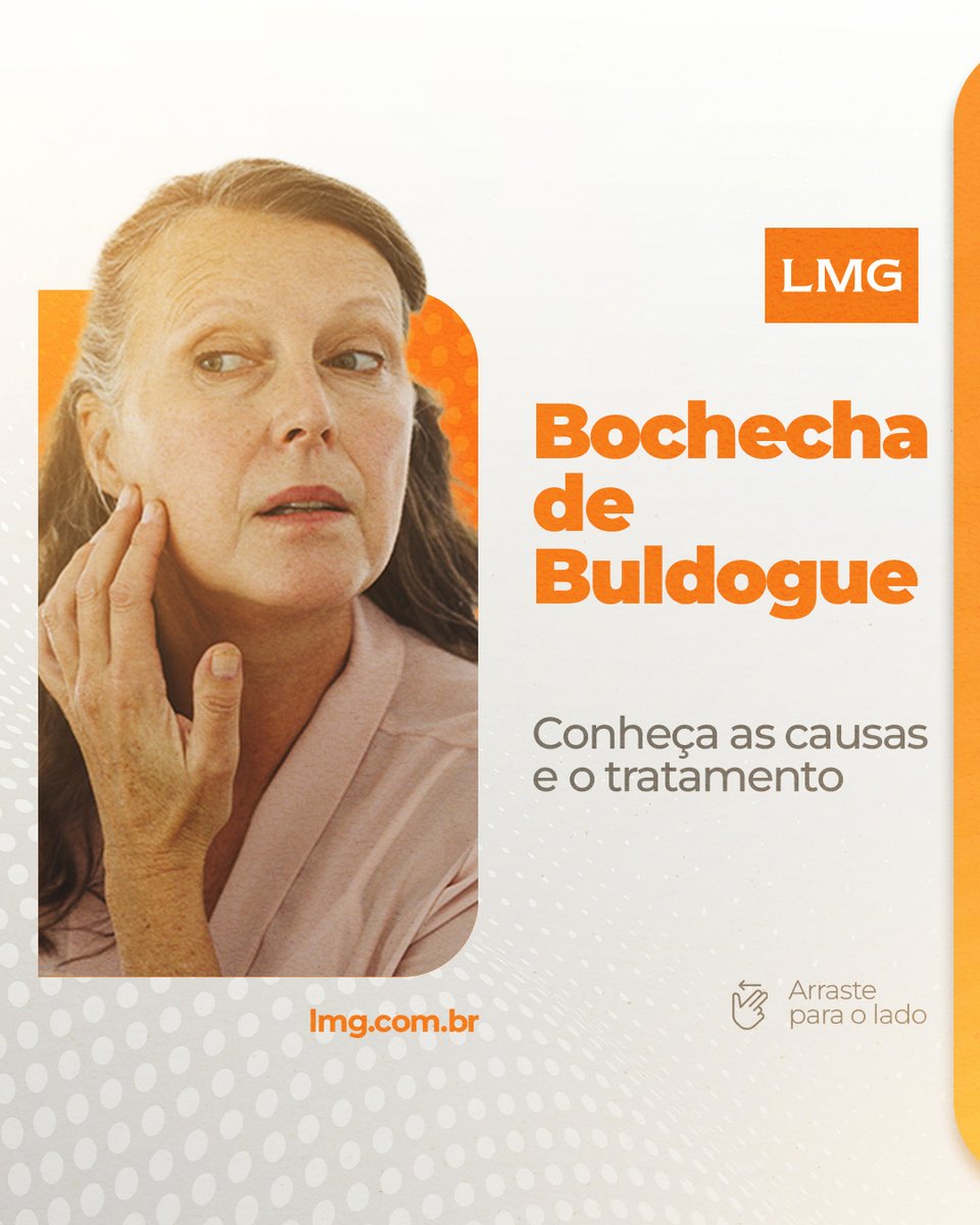 _wmbmarketing's tweet photo. Sabe aquelas bochechas que tanto incomodam e que dão aparência de “caídas”. Elas são resultados da flacidez no rosto, o que infelizmente é comum com o envelhecimento.
Acesse e confira post completo:https://t.co/Ne44cyXt7X
#lmglasers #Tecnologia #Procedimentos https://t.co/gFrGIU4tU0