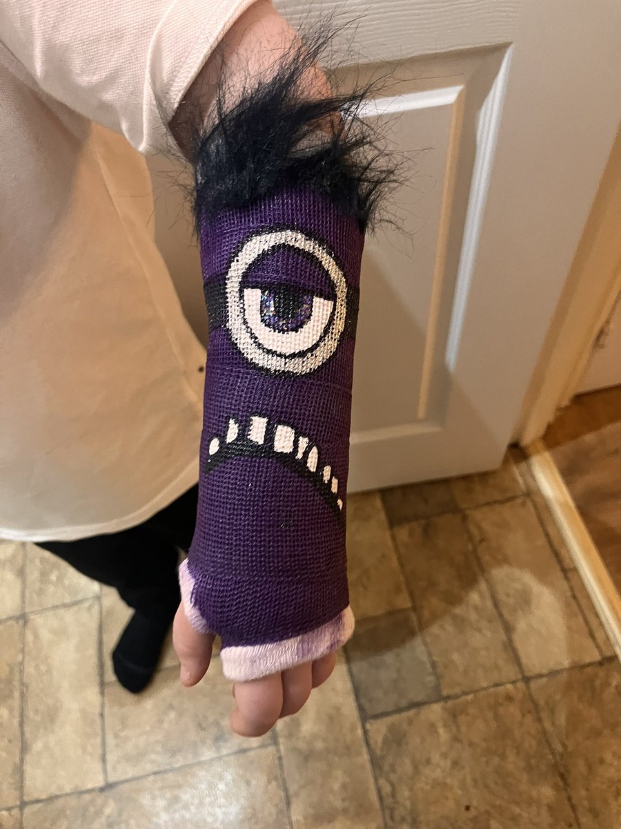 grant_becky78g's tweet photo. When they give you a purple cast and you don’t have any purple hair  #minion #minions #despicableme #fun #universalstudioshollywood  #hollywood #california #banana #happiness #losangeles #minionlove #friends #love #laugh #usa #happy #miami #despicable #smile  #minionstyle https://t.co/x0mlKJaqyT
