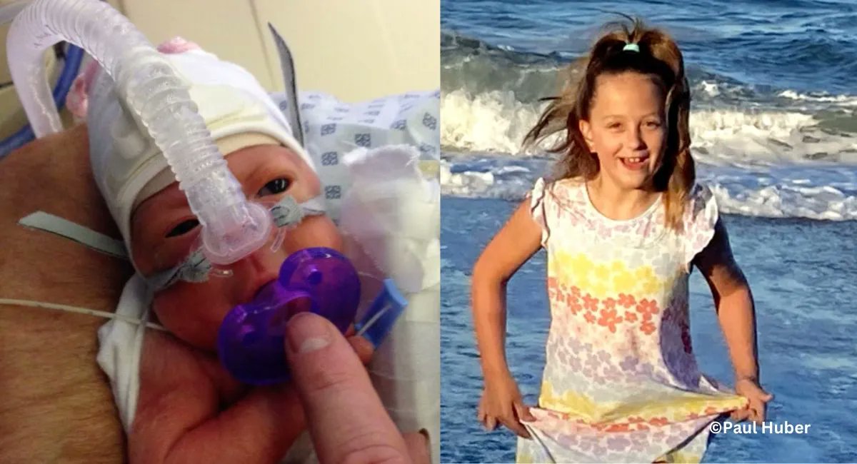 Live action news on twitter premature baby born at 26 weeks is now a