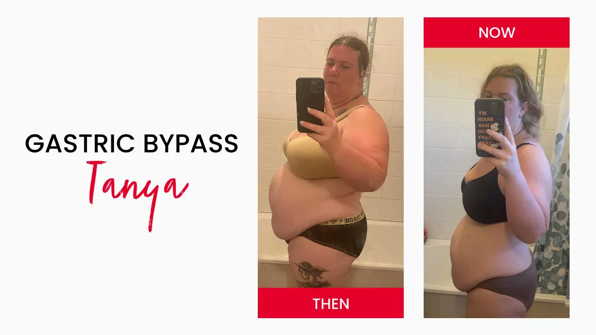 Meet Tanya, who in just six months since her gastric bypass procedure has lost almost 40kg! “I can’t believe how far I’ve come and how much better I feel!” Way to go, Tanya, we are SO proud of you! 💪 #wls #wlsaust #wlsaustralia #weightloss