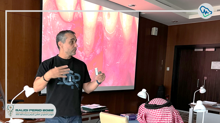 saudiperio's tweet photo. 🚩#HAPPENING_NOW : 

 Dr. Olivier Carcuac 

“The Modified Free Gingival Graft – An Innovative Approach For Treatment Of Gingival Recession Defect At Lower Anterior Teeth” 

 #SaudiPerio2022 https://t.co/D6eJsZoVof