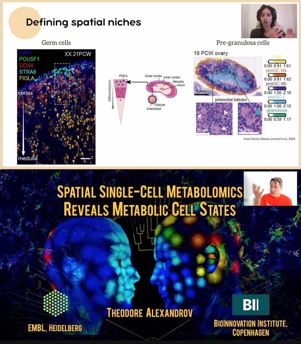 alpcorreia's tweet image. 🤩 Really inspiring insights by @vlorenzi3 (from @roserventotormo lab @sangerinstitute ) and @thalexandrov @embl on #SpatialTranscriptomics and #SpatialMetabolomics applied to development & disease. Thanks for the fantastic virtual visit to @ChampalimaudF , next time on-site!