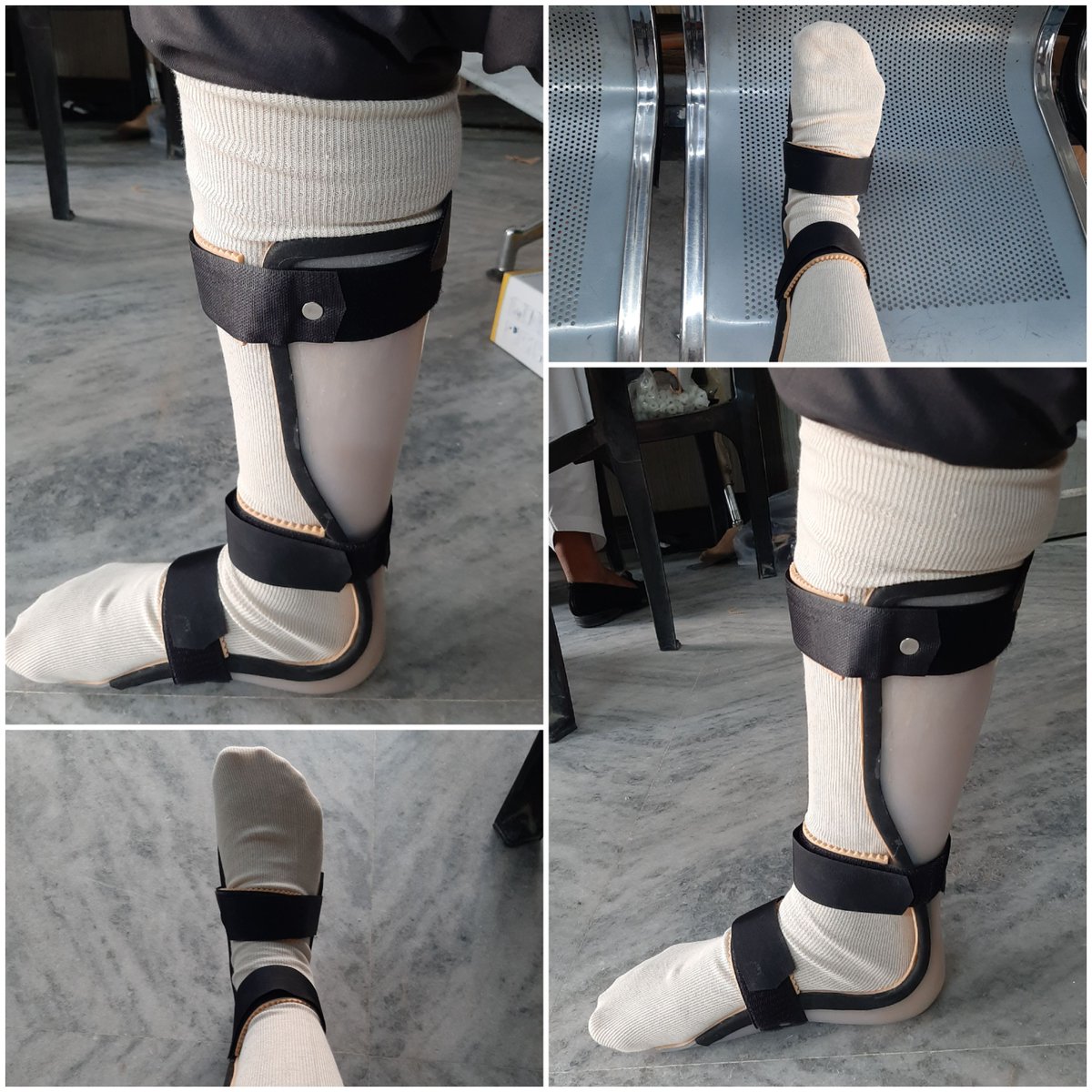 mycaremedical's tweet photo. foot drop afo
leaf afo for foot drop
custom made foot drop splint
customised afo brace for drop foot
foot drop shoe
#footdropshoe #footdropsplint #afo #leaf_afo #custom_drop_foot #footdropshoe #mycare_medical #nearme #after_stroke #post_stroke #anklefootorthosis #afterstroke https://t.co/iY8etdQqCo