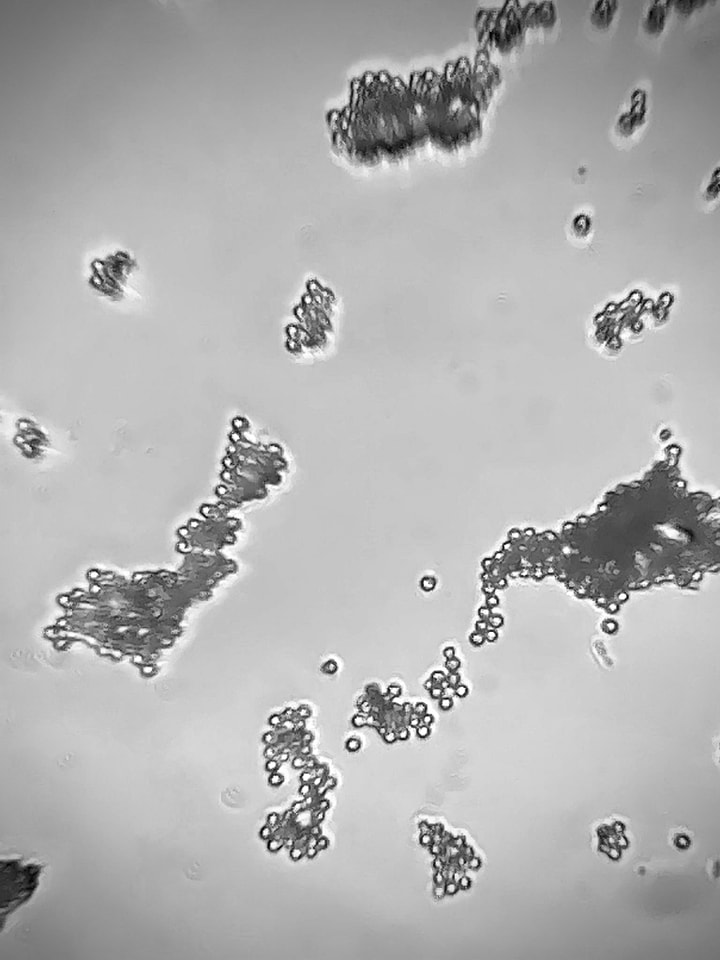ParcoBeigua's tweet photo. State guardando le spore di un Gasteromycetes, curioso fungo a forma di stella trovato nella raccolta di funghi #Beigua a scopo scientifico in Deiva sabato scorso per conoscere meglio i funghi e indagare dove l'occhio non può arrivare, utilizzando lenti e microscopi speciali https://t.co/ZlUh6H6otu