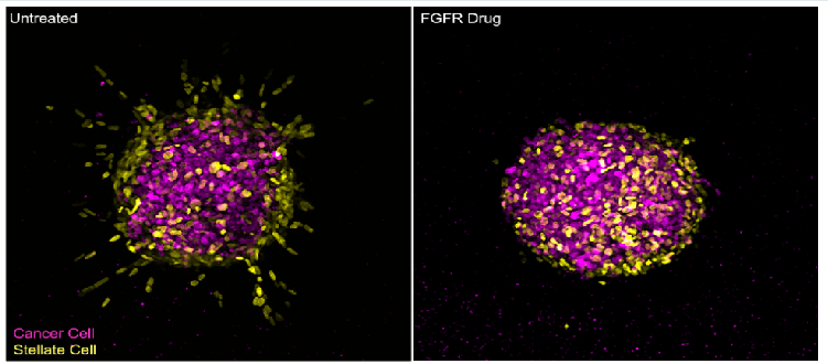 KocherLab (@labkocher) on Twitter photo rdcu.be/cZnSS
Excellent working together with <a href="/TheGroseLab/">Grose Lab</a>. #teamwork with <a href="/abigailwilson4/">Abigail Coetzee</a> <a href="/ECarter3D/">Edward Carter</a> and talented team of scientists. Funding support from <a href="/PanCanResearch/">PancreaticCancer Res</a> <a href="/Barts_Charity/">Barts Charity</a> <a href="/CR_UK/">Cancer Research UK</a>. rdcu.be/cZnSS
Excellent working together with <a href="/TheGroseLab/">Grose Lab</a>. #teamwork with <a href="/abigailwilson4/">Abigail Coetzee</a> <a href="/ECarter3D/">Edward Carter</a> and talented team of scientists. Funding support from <a href="/PanCanResearch/">PancreaticCancer Res</a> <a href="/Barts_Charity/">Barts Charity</a> <a href="/CR_UK/">Cancer Research UK</a>.