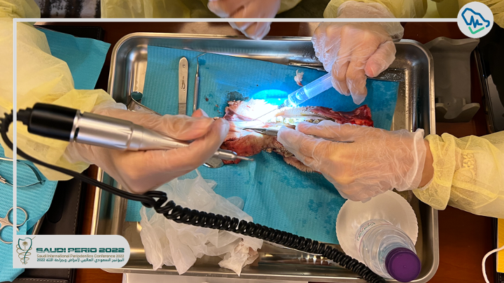 saudiperio's tweet photo. 🚩#HAPPENING_NOW : 

HANDS ON with Prof. Juan Mesquida 

"Minimally Invasive Approaches To Hard And Soft Tissue Management In The Esthetic Zone: Allografts 2022”  

 #SaudiPerio2022 https://t.co/iOaM6gpXPj