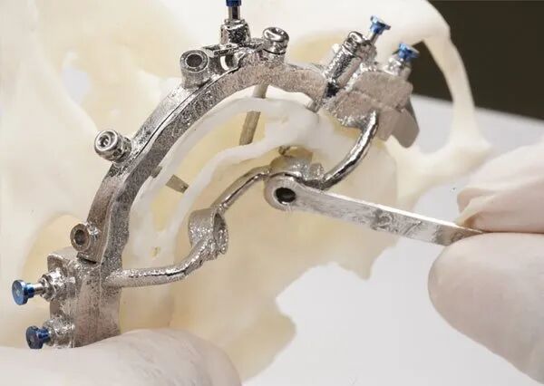 ROE Dental Lab tweet media