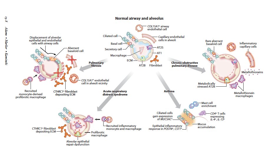 Finally out! Everything you ever wanted to know on lung cell atlases in health and disease, including a brief history of the 'atlas' concept, transcriptomic single-cell technologies &amp; the discoveries in #Asthma #COPD #PulmonaryFibrosis #ARDS  #COVID19 
annualreviews.org/doi/10.1146/