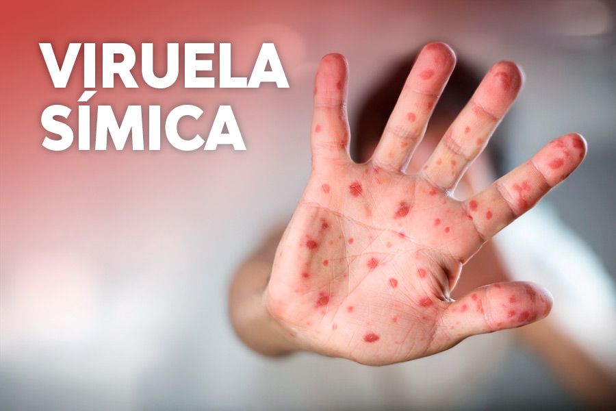 Jorge Schlottke (@jorge_schlottke) on Twitter photo Síntesis sobre estado del conocimiento: Viruela del mono.
El Observatorio de Salud de <a href="/UMazaOficial/">Universidad Maza</a> presenta y describe lo que se conoce a la fecha sobre viruela símica.
umaza.edu.ar/archivos/VIRUE… Síntesis sobre estado del conocimiento: Viruela del mono.
El Observatorio de Salud de <a href="/UMazaOficial/">Universidad Maza</a> presenta y describe lo que se conoce a la fecha sobre viruela símica.
umaza.edu.ar/archivos/VIRUE…
