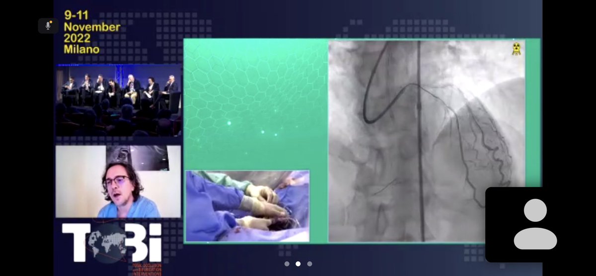 Stefan Harb (@stefan_harb) on Twitter photo XTR turned intraluminal knuckle after passing CTO <a href="/tobicongress/">TOBI Total Occlusion Bifurcation Interventions</a> #TOBI22 XTR turned intraluminal knuckle after passing CTO <a href="/tobicongress/">TOBI Total Occlusion Bifurcation Interventions</a> #TOBI22