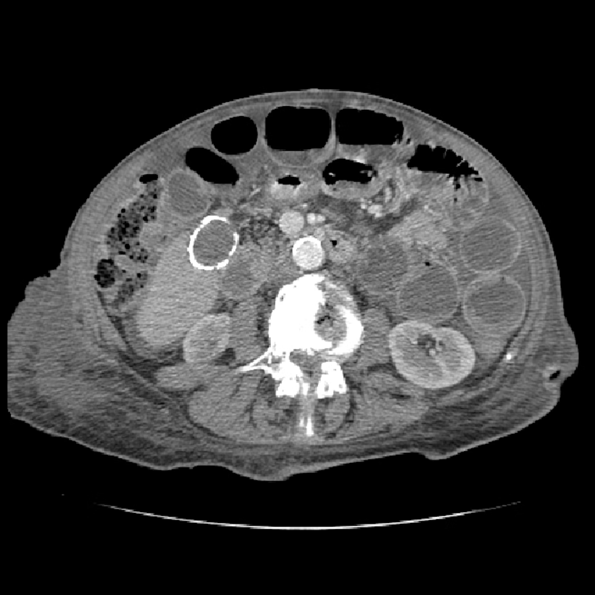 EndoCollab GI Endoscopy Community on Twitter "Quiz on Biliary