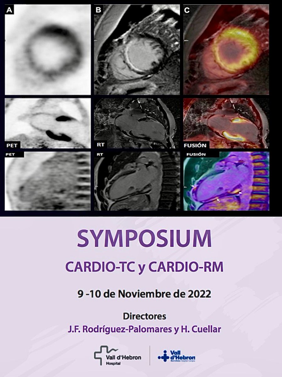 La Dra. Leticia Fernandez Friera habla, en estos momentos, en el prestigioso Hospital Vall d'Hebron de Barcelona acerca de la imagen cardiaca avanzada, en particular, sobre la tecnología para estudiar la inflamación del corazón, el PET-Resonancia.

#imagencardiacaavanzada
