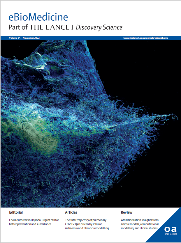 eBioMedicine's tweet photo. Our November issue is now online! We will share a few highlights in the coming weeks

A lot of exciting research about  #infectiousdiseases #SARSCoV2 #oncology #tremors #exercise &amp; more

Table of contents https://t.co/yhMvsF0REZ

Register for content alert https://t.co/7EWoaSAPaq https://t.co/ZQDabiLkTT
