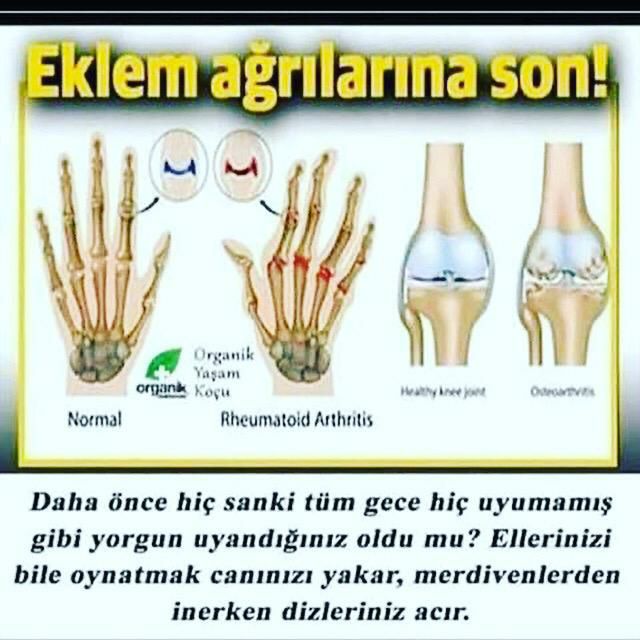 onemoremalatya's tweet photo. https://t.co/x50leRVwV7