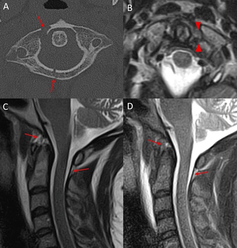 Peter Fiester, MD tweet media
