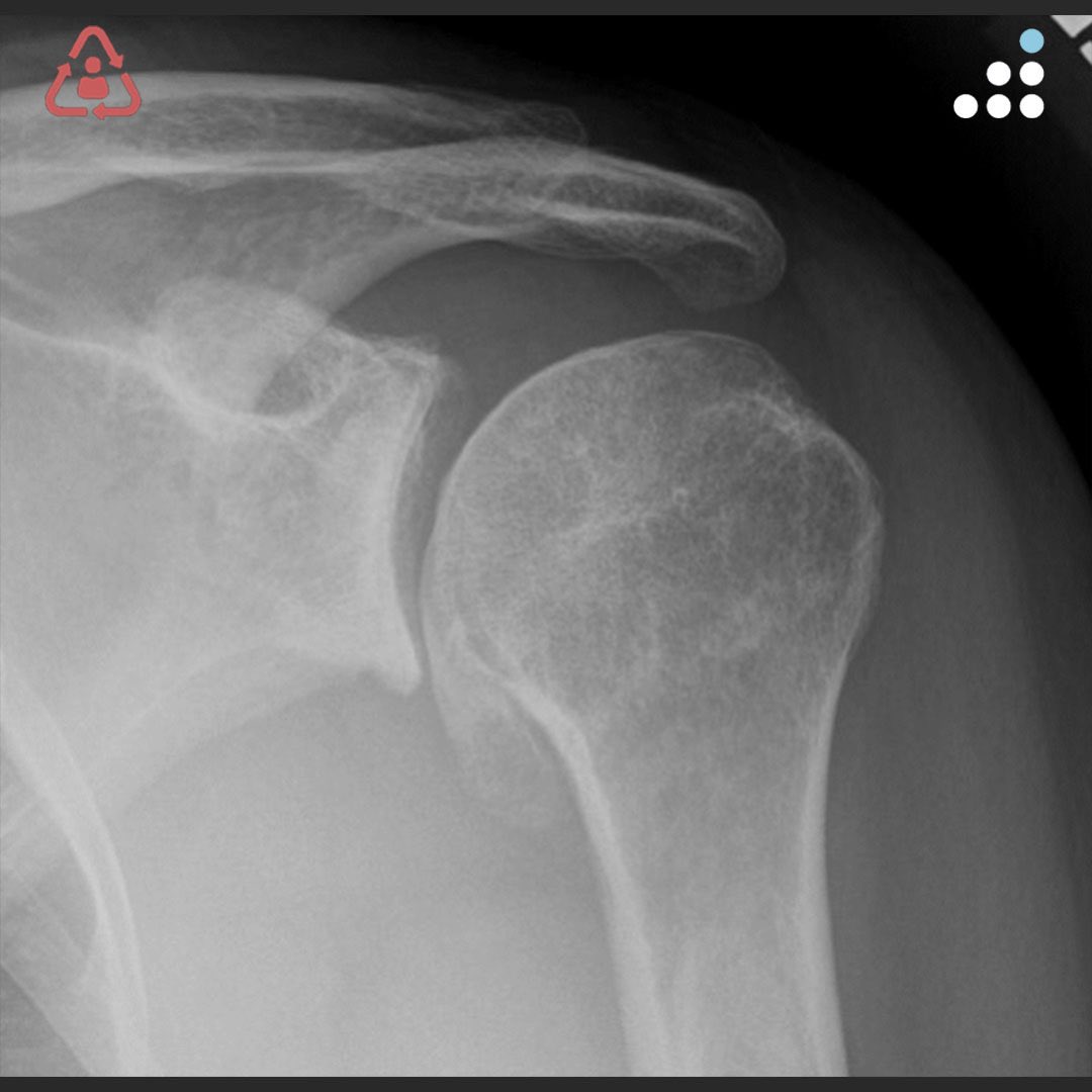 Orthobullets tweet media