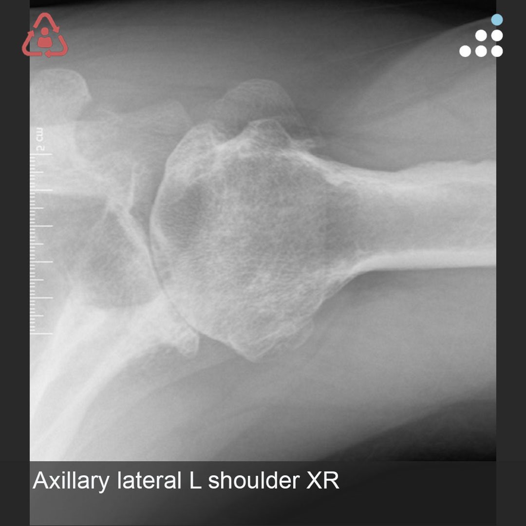 Orthobullets tweet media