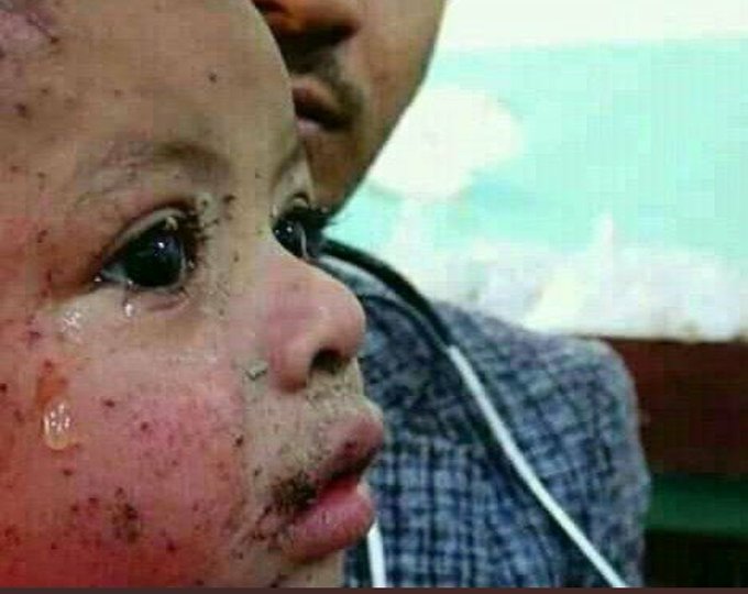 دموعه ستكون عليهم انهار من الدموع
منظره يدمي القلب 💔😢
اين جمعيات حقوق الطفل ؟؟؟؟؟
                          #أنـصـروا_أطفال_اليمن