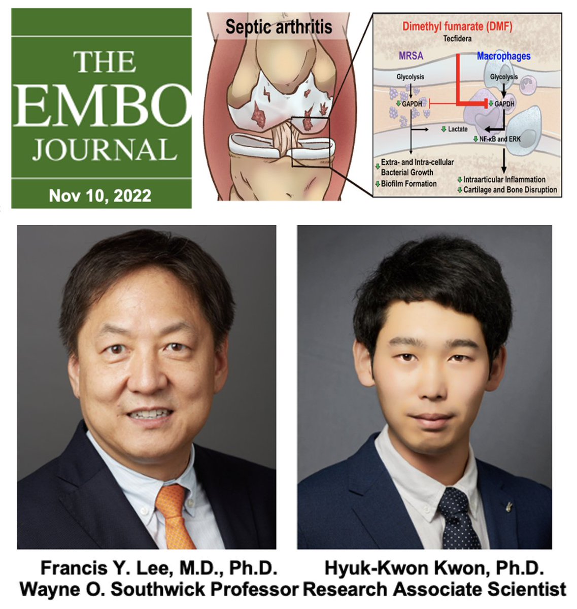 Dr. Francis Lee, NIH-funded Orthopaedic Surgeon Scholar and Musculoskeletal #TumorSurgeon, & Research Associate Dr. Hyuk-Kwon Kwon unraveled immune-metabolic mechanisms of septic arthritis - bit.ly/3WPX6zu. #OrthoTwitter #MusculoskeletalOncology #OrthoOncology #OrthoOnc