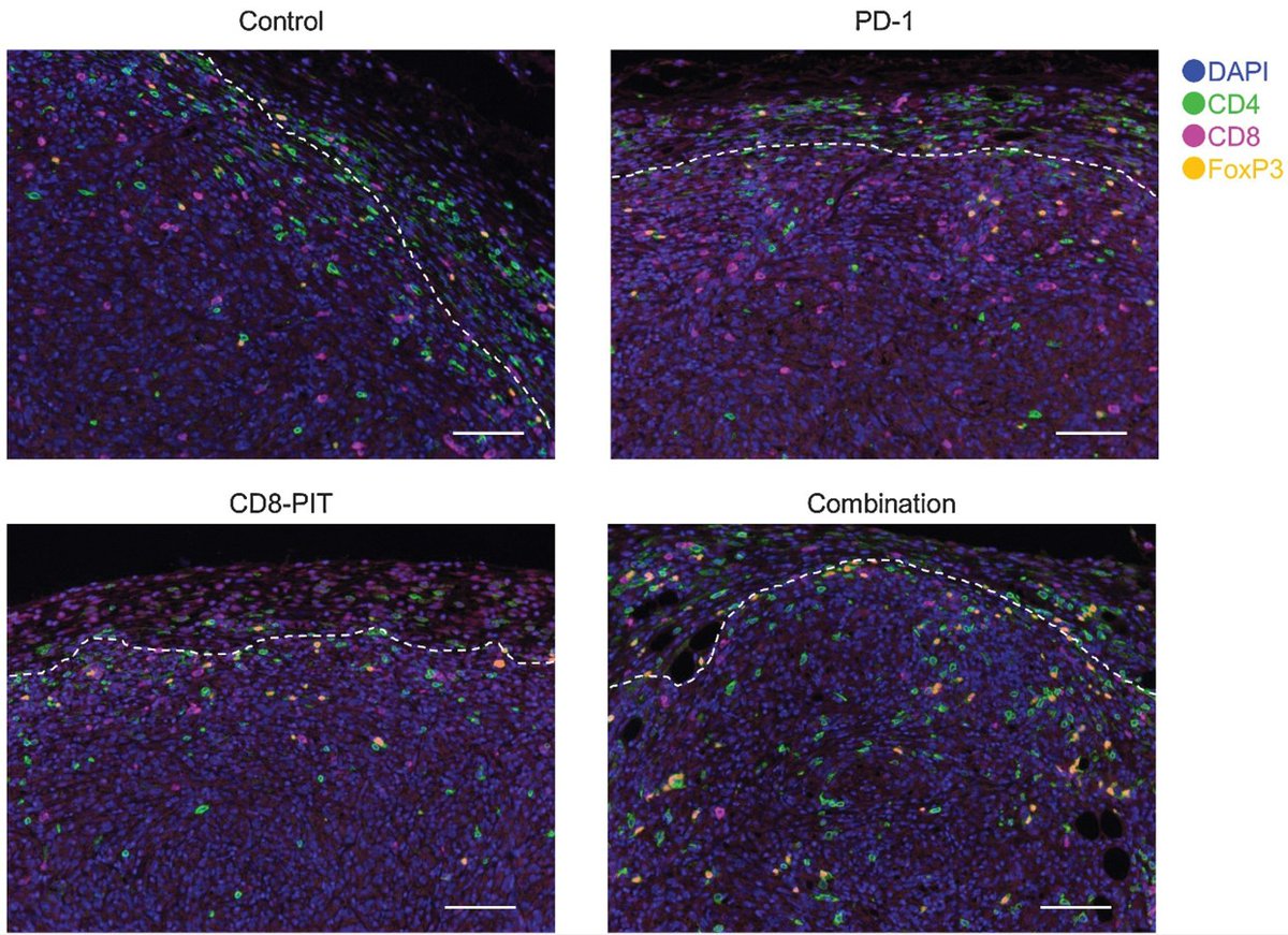 CIR_AACR's tweet photo. Studying #hyperprogressivedisease (HPD) associated with PD1 blockade? In this study by Wakiyama, Kobayashi et al., HPD is reproduced by paritally eliminating specific cell types using NIR-PIT, and HPD-promoting cells are identified. Learn more:
https://t.co/8EUfMyH339
@PChoyke https://t.co/fBdA3o3kQE