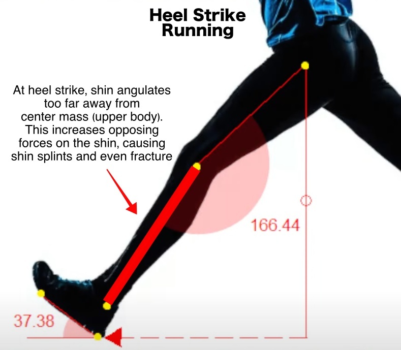Bretta Riches on Twitter "Heel strike running causes shin splints by