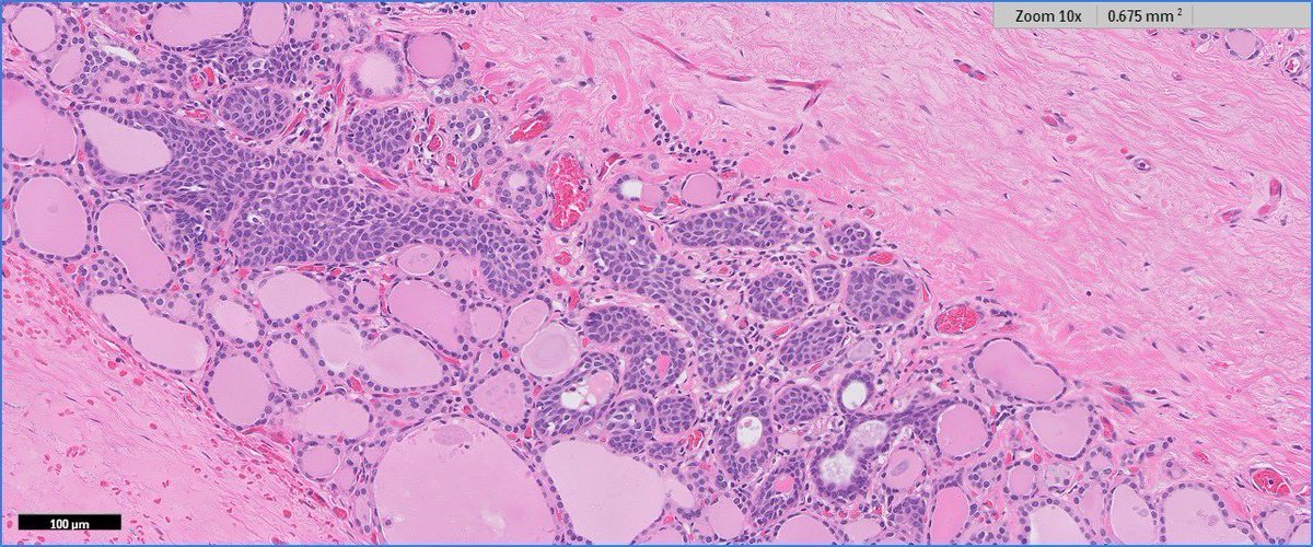 #pathresidents #pathnewbies What do you 👀 in this image? #PathTwitter