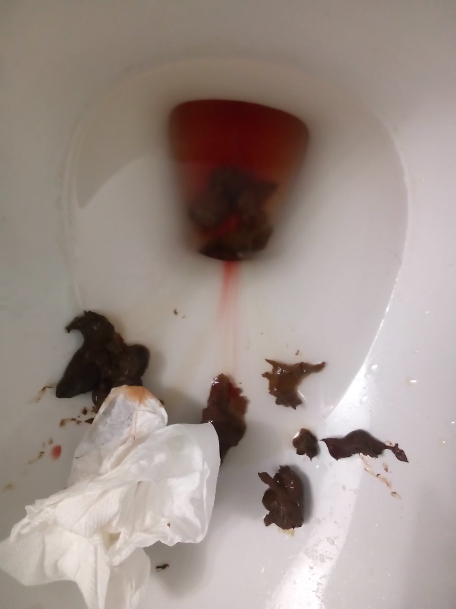 GravesGod's tweet image. I'm A VERY SICK LADY..I HAVE PARASITIC WORM INFECTIONS .CONSTIPATION S, HERNIA.FROM Leesa Scalise POISONED ME WITH CAT, DOG, PIGEONSHIT, Scalise SHIT,AJAX WITH BLEACH,but SATAN FUCKER HORNY DOG WAREWOLF FUCKER Leesa SCALISE ACCUSES ME ON THE STREET! forgive I got to show.I REST