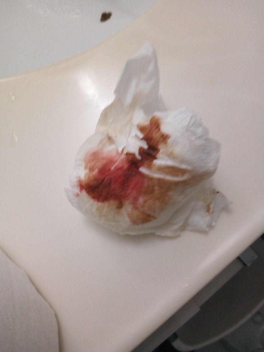 GravesGod's tweet image. I'm A VERY SICK LADY..I HAVE PARASITIC WORM INFECTIONS .CONSTIPATION S, HERNIA.FROM Leesa Scalise POISONED ME WITH CAT, DOG, PIGEONSHIT, Scalise SHIT,AJAX WITH BLEACH,but SATAN FUCKER HORNY DOG WAREWOLF FUCKER Leesa SCALISE ACCUSES ME ON THE STREET! forgive I got to show.I REST