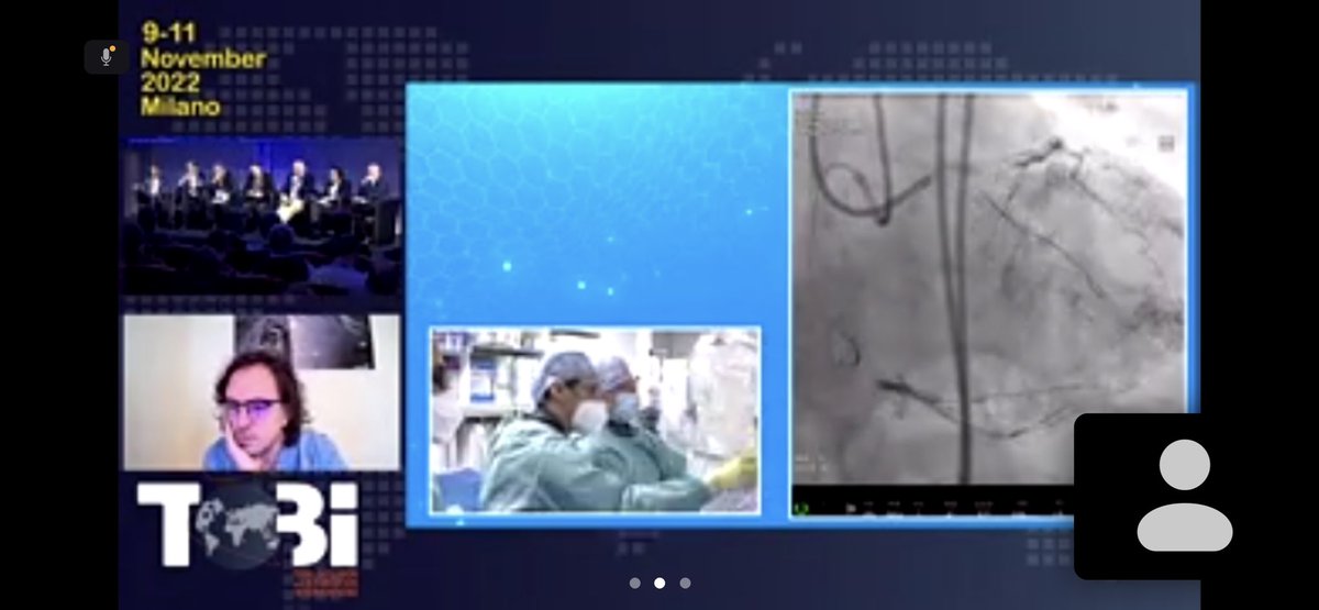 Stefan Harb (@stefan_harb) on Twitter photo #TOBI22 <a href="/tobicongress/">TOBI Total Occlusion Bifurcation Interventions</a>
high end #CTO #PCI techniques
presented by <a href="/KambisMashayek1/">Kambis Mashayekhi</a> & Alexandre Avran
discussed by
Masahisa Yamane and George Sianos
“are large epicardials more dangerous than small ones?” #TOBI22 <a href="/tobicongress/">TOBI Total Occlusion Bifurcation Interventions</a>
high end #CTO #PCI techniques
presented by <a href="/KambisMashayek1/">Kambis Mashayekhi</a> & Alexandre Avran
discussed by
Masahisa Yamane and George Sianos
“are large epicardials more dangerous than small ones?”