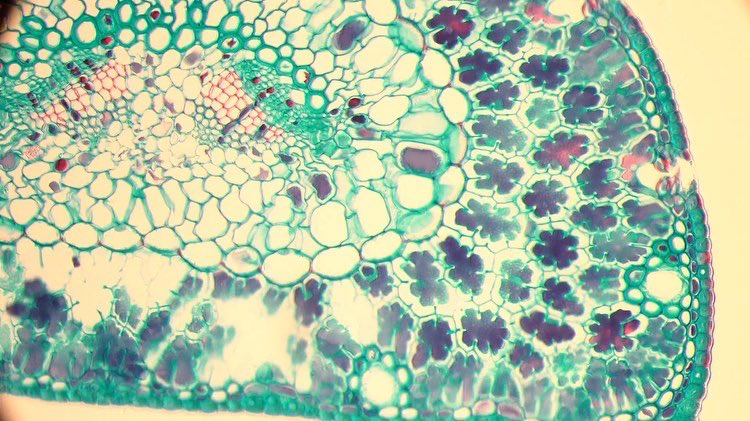 4kStem's tweet photo. @STEMcha Cross section of a pine leaf under different levels of magnification (4x, 10x, 20x)! The outside, darker spots are different views of epidermis - basically the skin of the leaf! The inside of the leaf is filled with tissues, which has vessels called xylem and phloem. https://t.co/aIrouSgM60