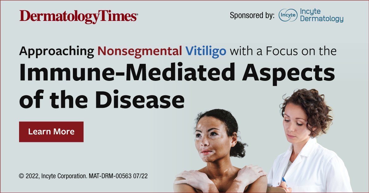 Learn about approaching nonsegmental vitiligo with a focus on the immune-mediated aspects of the disease. ow.ly/GPuf50KKrs4