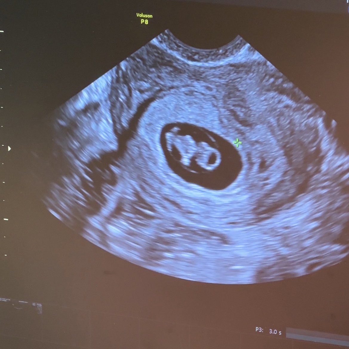 expectation vs. reality 🫢